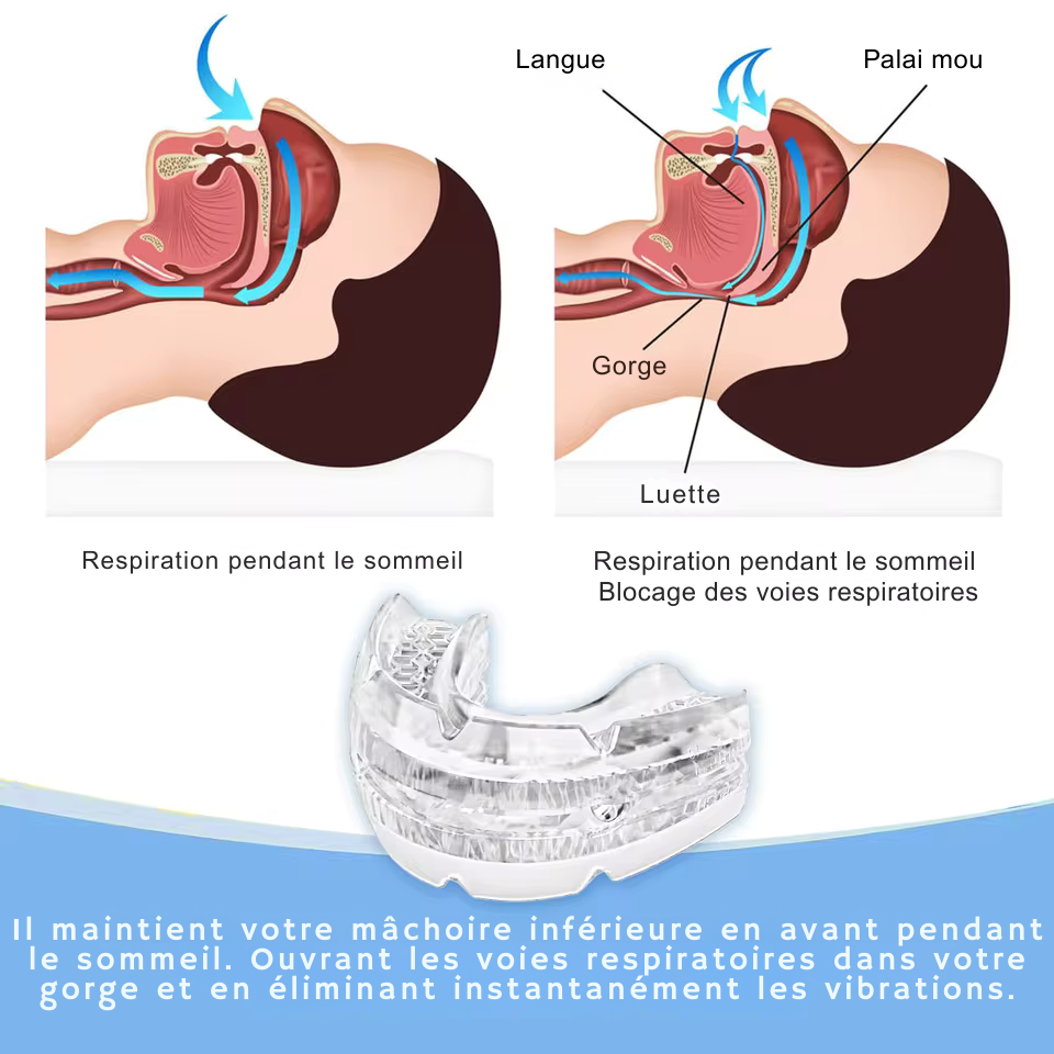 Somneva — La solution simple pour des nuits sans ronflements